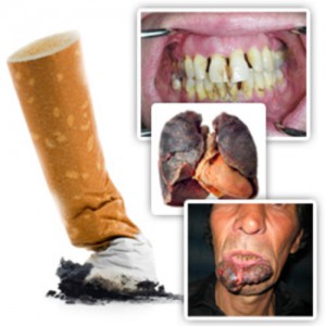 296957_120619132644_smoking-diseases